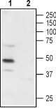 P2X3 Receptor (extracellular) Blocking Peptide