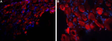 Anti-P2X3 Receptor (extracellular) Antibody