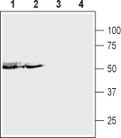 P2X5 Receptor (extracellular) Blocking Peptide