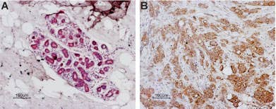 Anti-Human PAR1 (F2R) (extracellular) Antibody