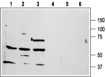Human PAR1/F2R (extracellular) Blocking Peptide