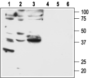 Anti-PAR2 (F2RL1) Antibody