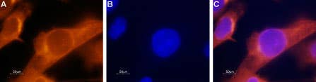 Anti-PAR2 (F2RL1) Antibody