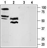 PAR4/F2RL3 (extracellular) Blocking Peptide