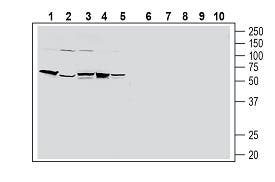 Human PAR2/F2RL1 (extracellular) Blocking Peptide