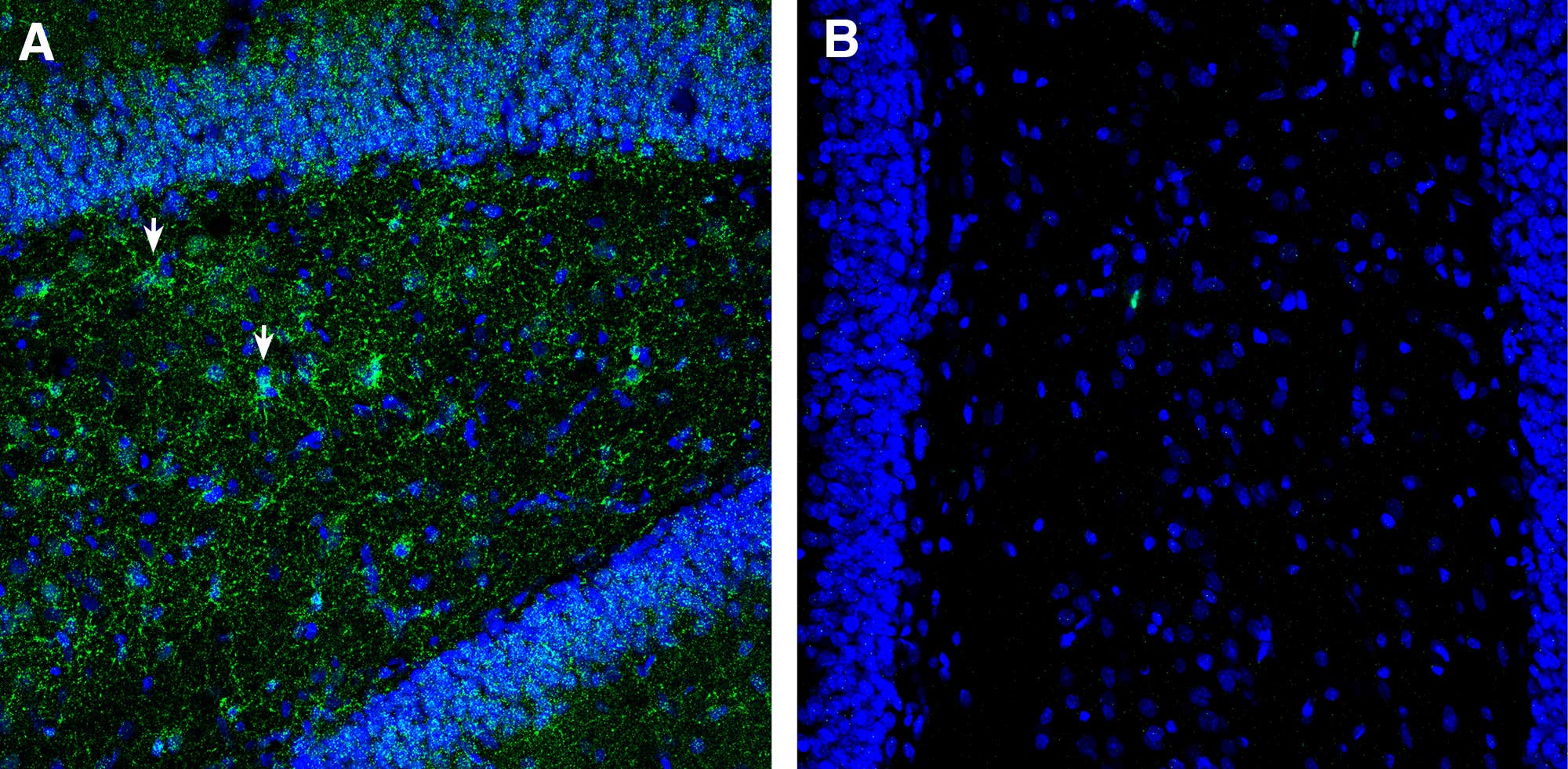 Anti-PAR1 (F2R) (extracellular) Antibody