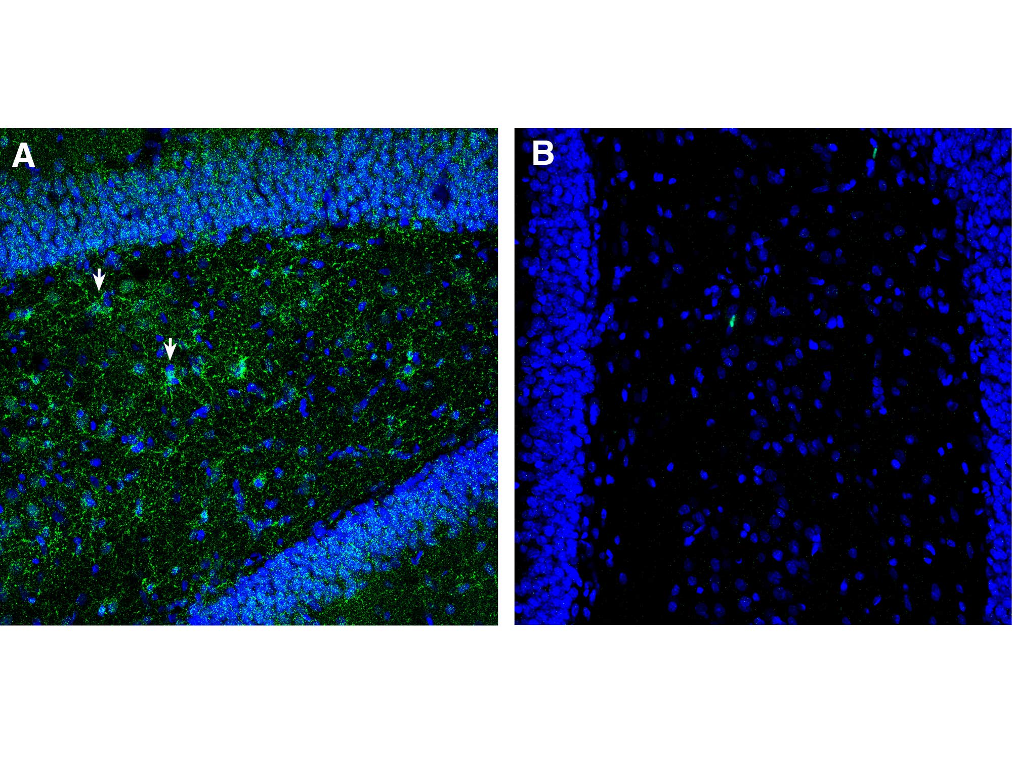 Anti-PAR1 (F2R) (extracellular) Antibody