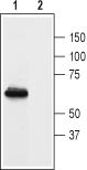 Prokineticin Receptor 1 (extracellular) Blocking Peptide