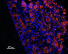 Anti-Prokineticin Receptor 1 (extracellular) Antibody