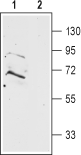 Prokineticin Receptor 2 (extracellular) Blocking Peptide