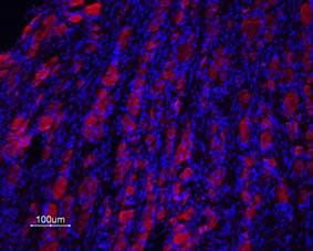 Anti-Prokineticin Receptor 2 (extracellular) Antibody
