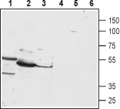 PTH1R (extracellular) Blocking Peptide