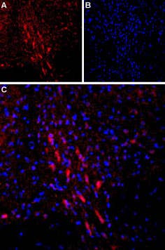 Anti-PTH1R (extracellular) Antibody