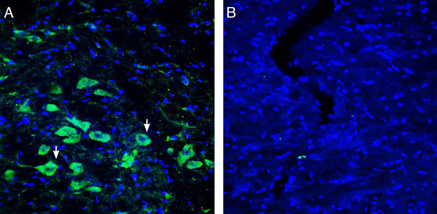 Anti-Platelet-activating factor receptor (extracellular) Antibody