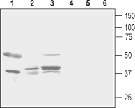 Prostaglandin E Receptor EP2/PTGER2 (extracellular) Blocking Peptide