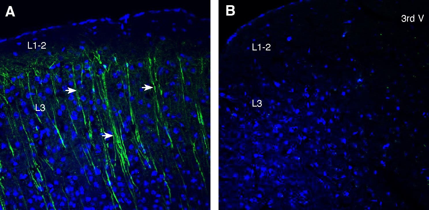 Anti-Prostaglandin E Receptor EP3 (PTGER3) Antibody
