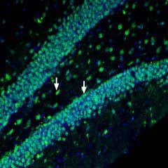 Anti-Prostaglandin F2-α Receptor/PTGFR Antibody