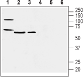 Anti-Prostacyclin Receptor (PTGIR) (extracellular) Antibody