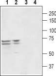 PEX5L/TRIP8b Blocking Peptide
