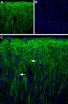 Anti-PEX5L (TRIP8b) Antibody