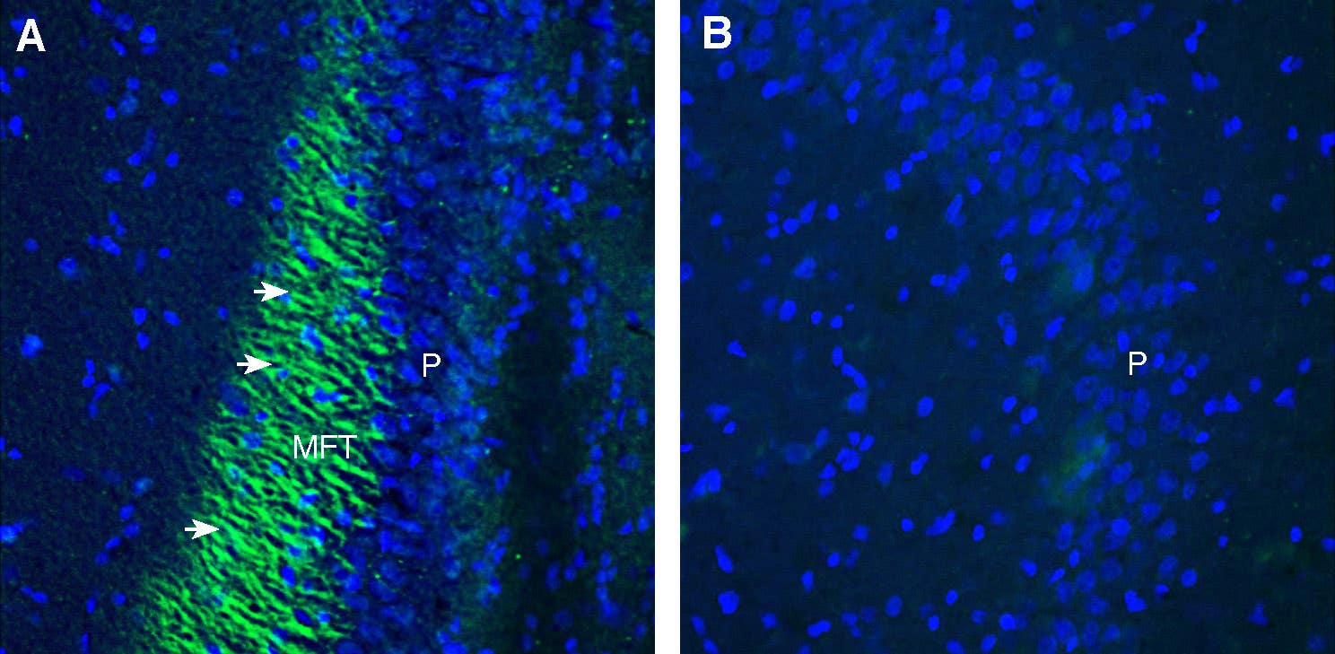 Anti-Plexin-A4 (extracellular) Antibody