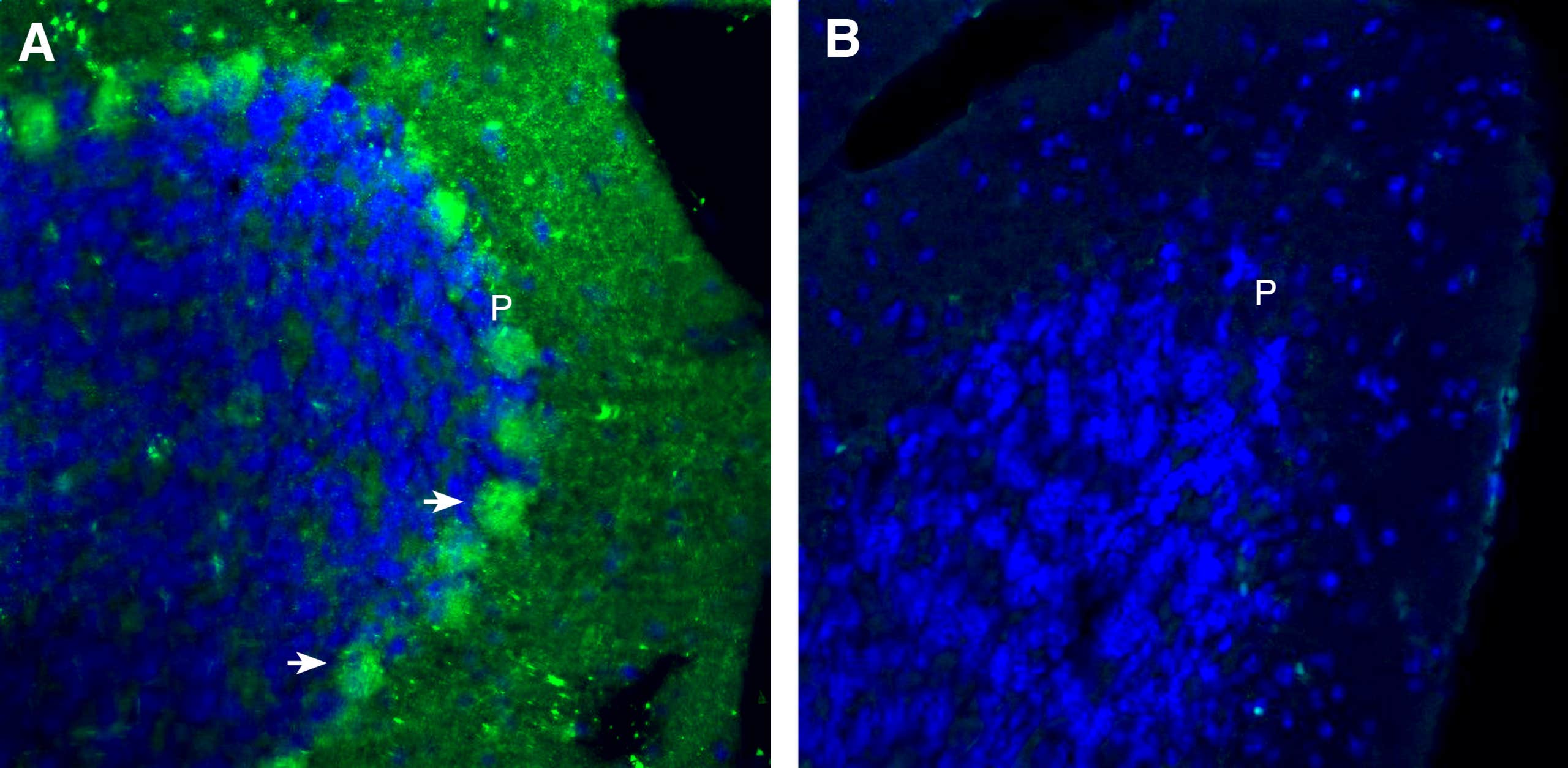 Anti-Plexin-B1 (extracellular) Antibody
