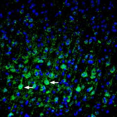 Anti-Plexin-A3 (extracellular) Antibody