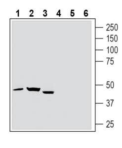 Anti-Thromboxane A2 Receptor (extracellular) Antibody