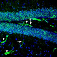 Anti-P2Y2 Receptor (extracellular) Antibody