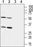 P2Y6 Receptor (extracellular) Blocking Peptide