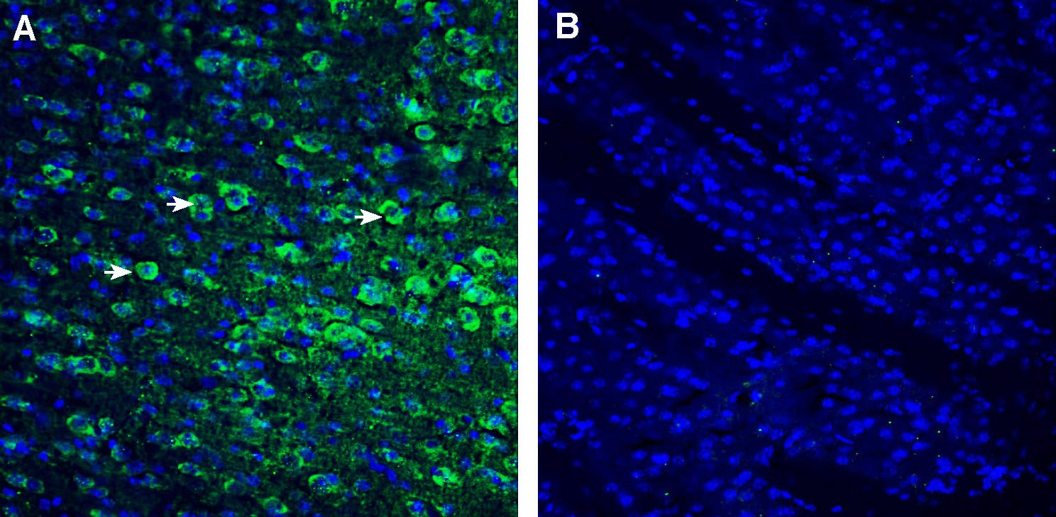 Anti-P2Y10 (extracellular) Antibody