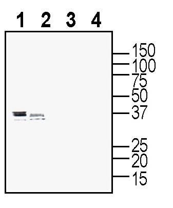 Anti-P2Y10 (extracellular) Antibody - Carrier Free