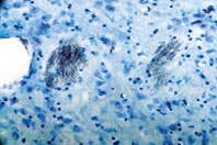 Anti-P2Y1 Receptor Antibody