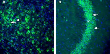 Anti-Thromboxane A2 Receptor Antibody