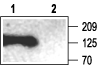 Anti-SAP102 Antibody