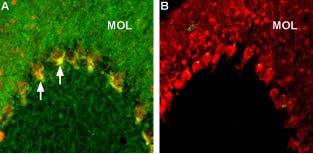 Anti-Caspr2 Antibody