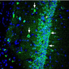 Anti-Shank1 Antibody