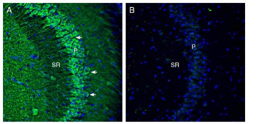 Anti-Cortactin Antibody