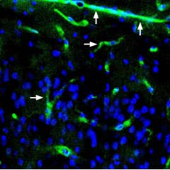 Anti-α1-Syntrophin (SNTA1) Antibody