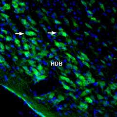 Anti-Homer3 Antibody
