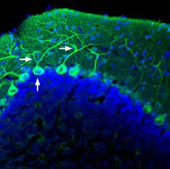 Anti-AKAP12 Antibody