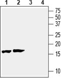 Beta-Synuclein Blocking Peptide