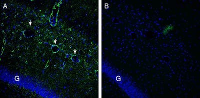 Anti-Gamma-Synuclein Antibody