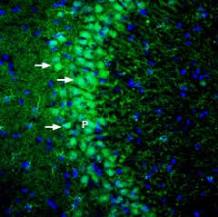 Anti-DLGAP1/GKAP Antibody
