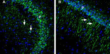 Anti-GIPC1 Antibody