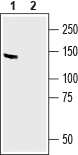MAGI2/AIP1 Blocking Peptide