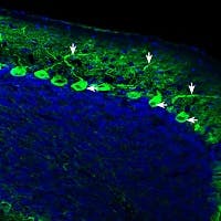 Anti-IQGAP1 Antibody