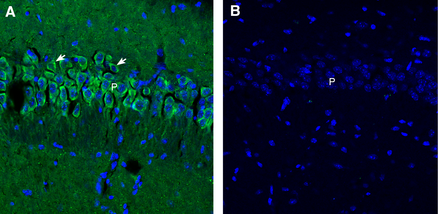 Synaptojanin 1 Blocking Peptide
