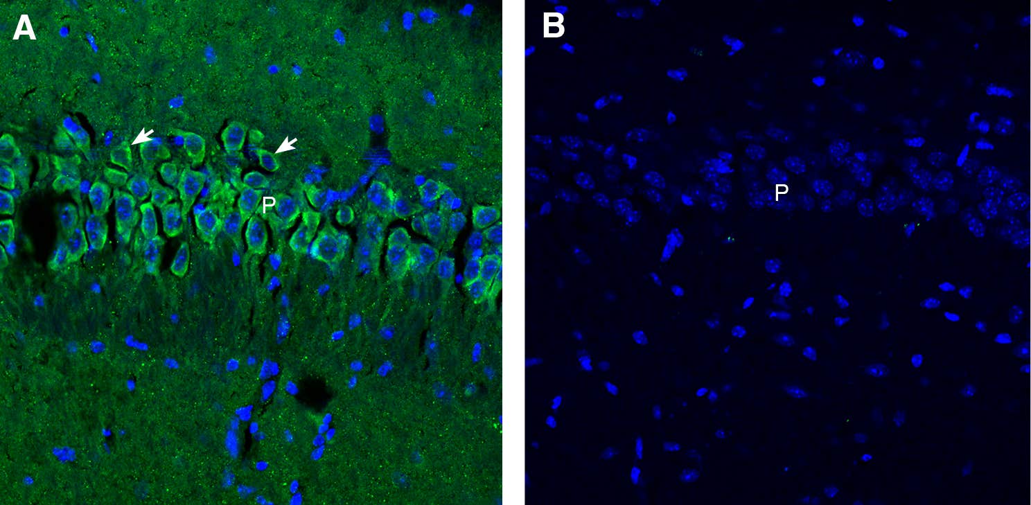 Anti-Synaptojanin 1 Antibody - Carrier Free