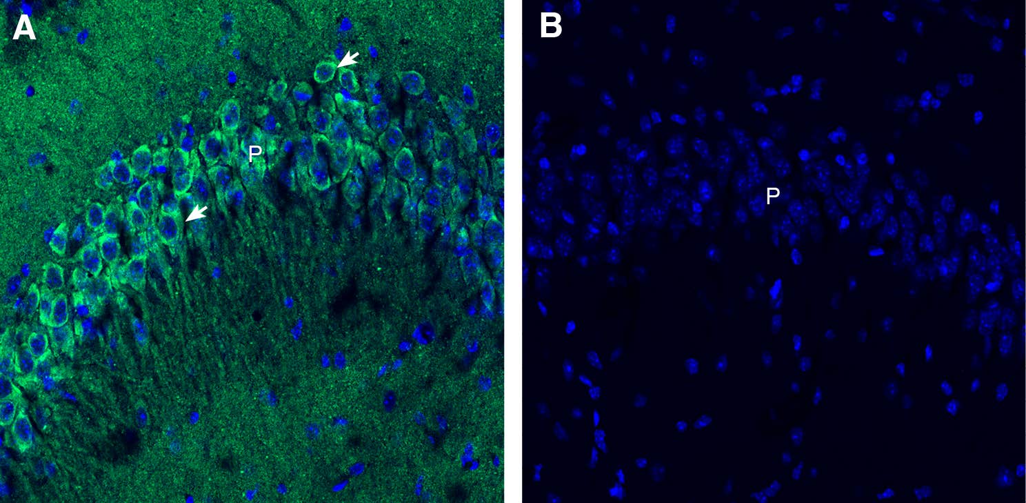 Anti-Endophilin-A1 Antibody - Carrier Free